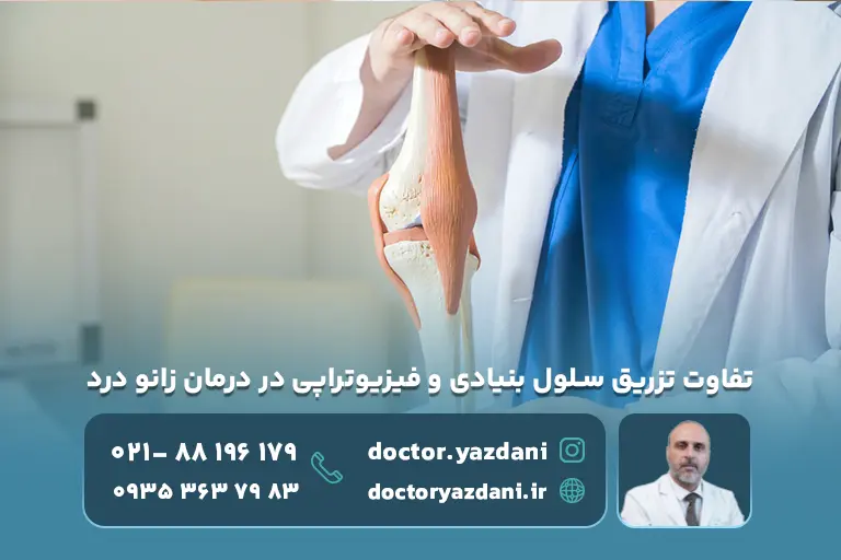 تفاوت تزریق سلول بنیادی و فیزیوتراپی در درمان زانو درد